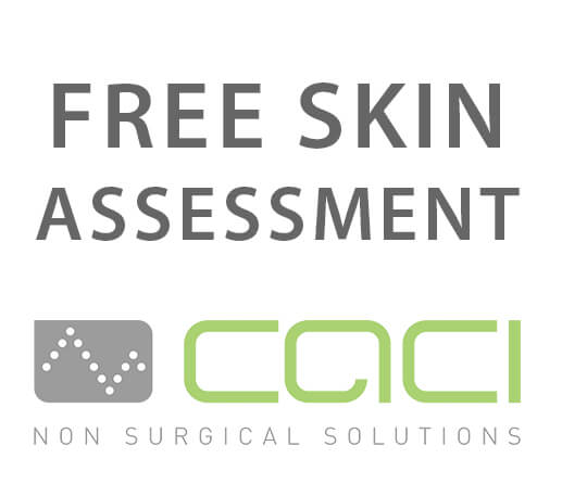 CACI Free Assessment - 10 mins