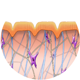 before, skin collagen matrix, Exilis Ultra 360 treatment at wimbledon clinic aesthetics