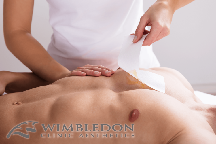 male waxing wimbledon back and chest waxing services