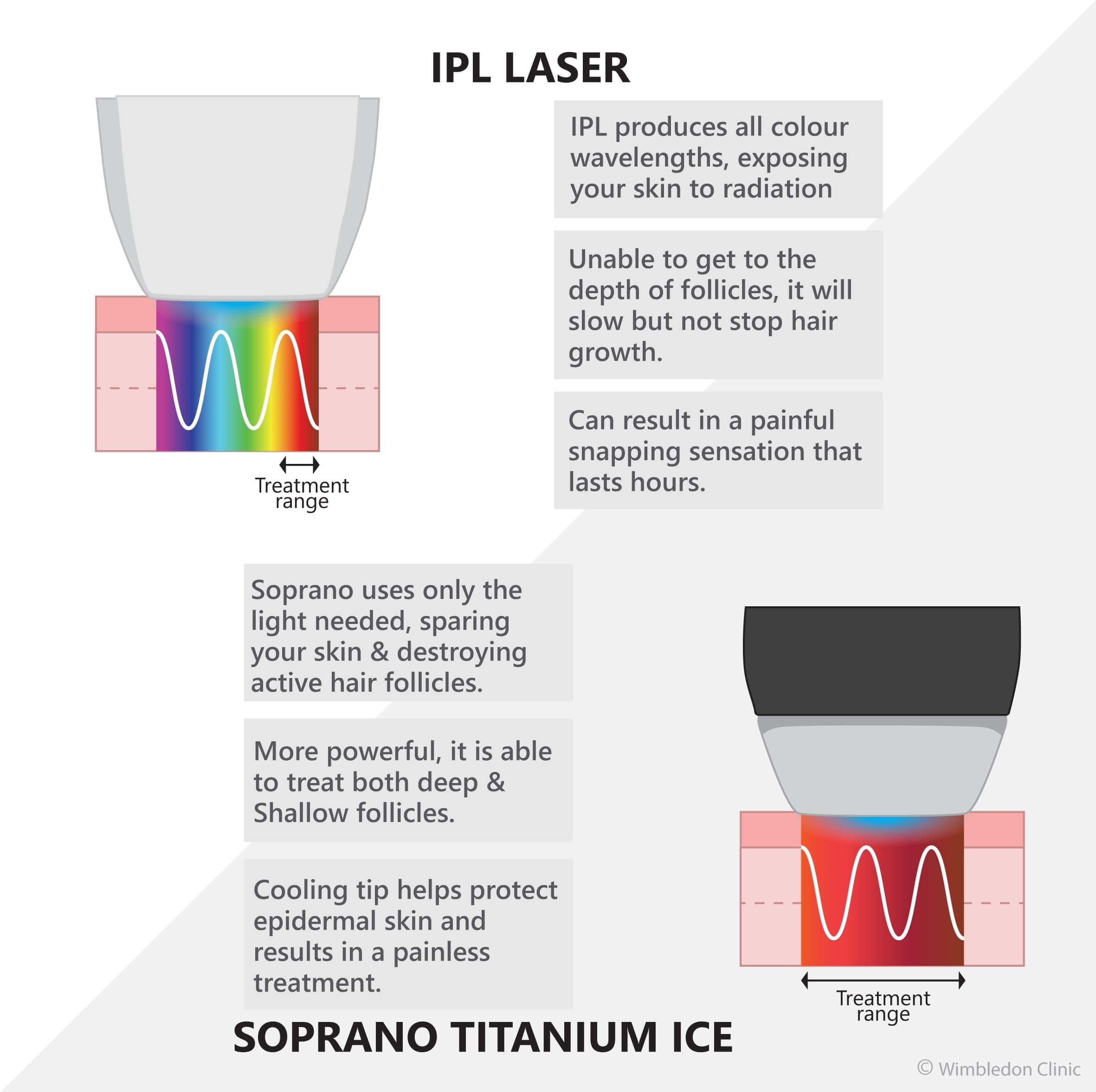 IPL soprano Titanium benefits verses laser wavelength treatment range